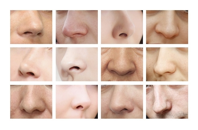 NOSE BEFORE AND AFTER